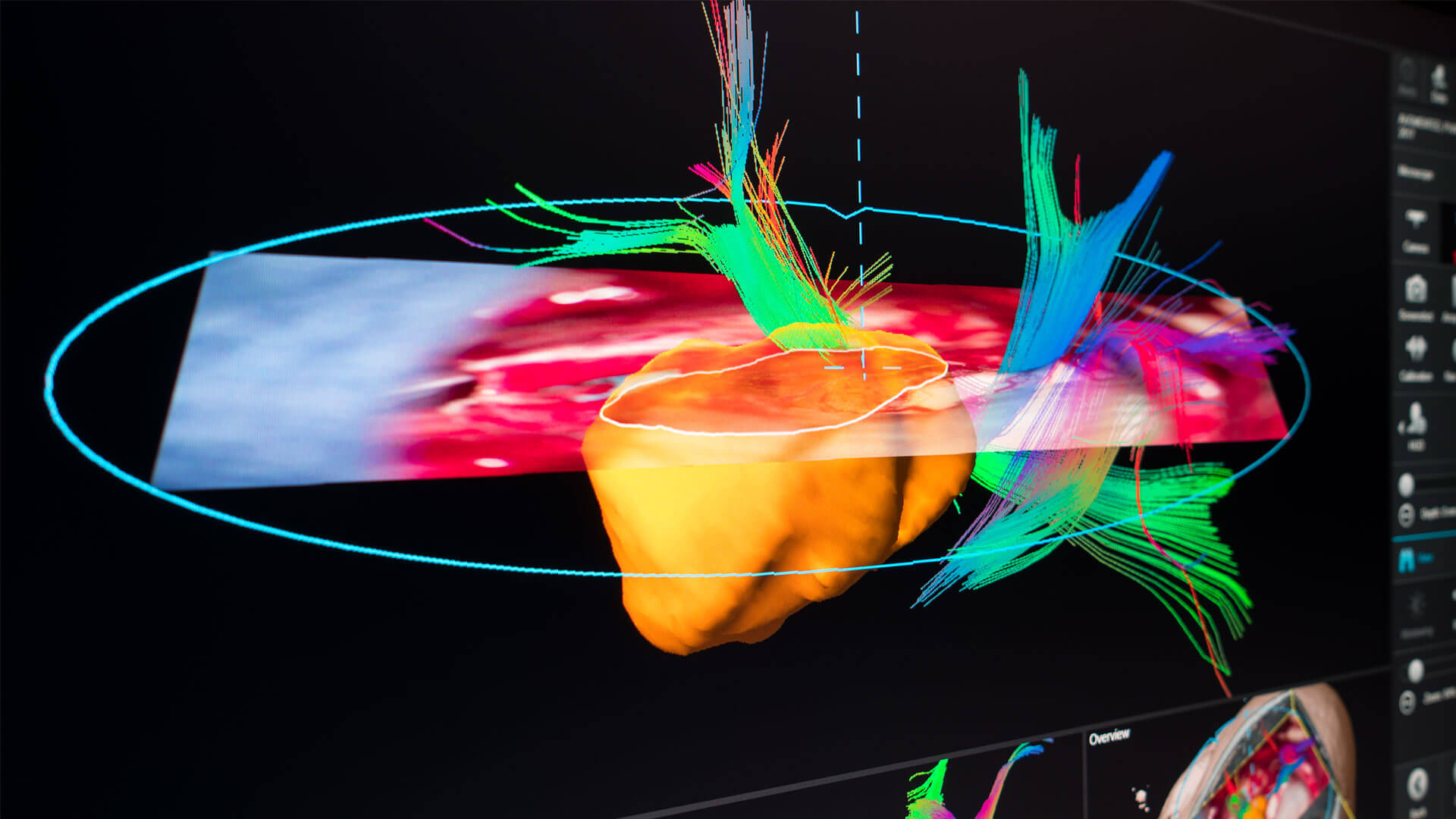 Cranial Navigation: Advanced Neuronavigation | Brainlab